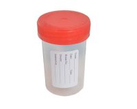 urine container